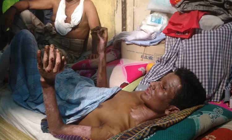 petrol bomb attack, attack against rohingyan, refugee, myanmar