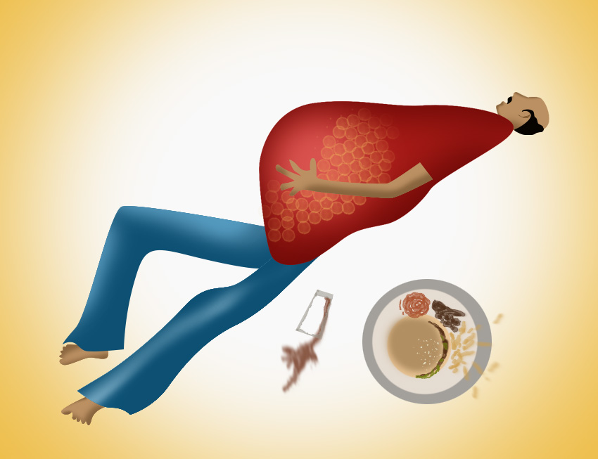 nash, nash liver, nonalcoholic steatohepatitis, steatohepatitis, nash cirrhosis, nash disease, what is nash, alcohol-related liver disease, കരള്, കരള് രോഗം, കരള് രോഗങ്ങള്, കരള് വീക്കം, കരള് മാറ്റം